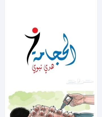 الحجامة المنزلية وطلبات المنازل